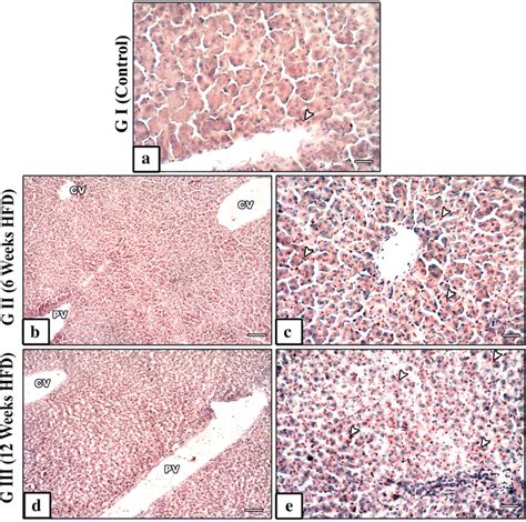 Photomicrographs Of Sudan III Stained Sections Of The Rat Liver Group