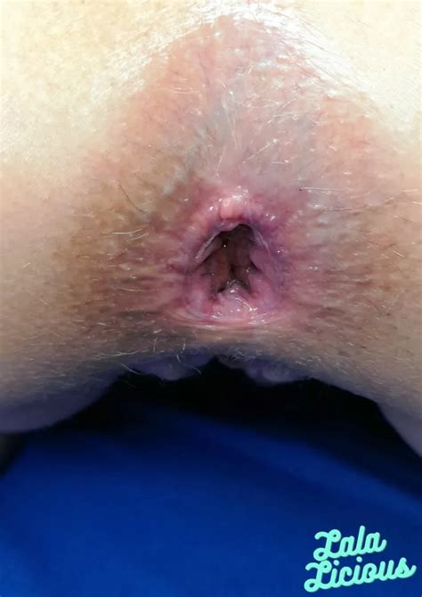 My Silver Heart Butt Plug Expulsion Nude Pics XHamster