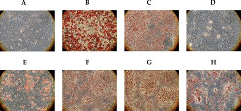 Oil Red O Stained 3t3 L1 Cells Treated Under Different Differentiation