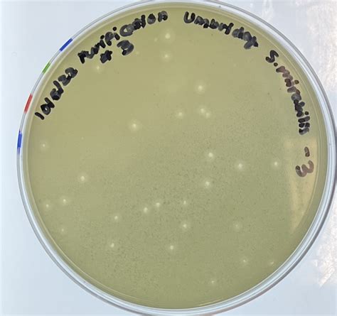 actinobacteriophage  phage umbridge