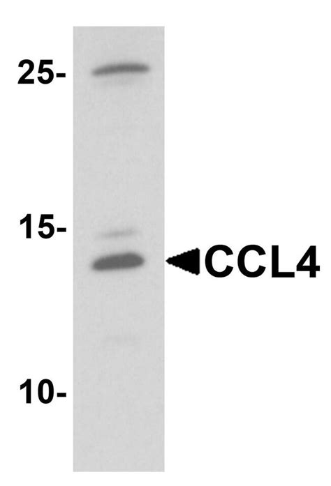Ccl4 Polyclonal Antibody Invitrogen 100 μg Unconjugatedantibodies