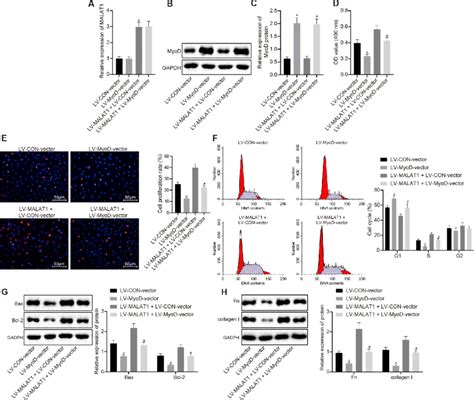 Over Expression Of Lncrna Malat Promotes Cell Proliferation And