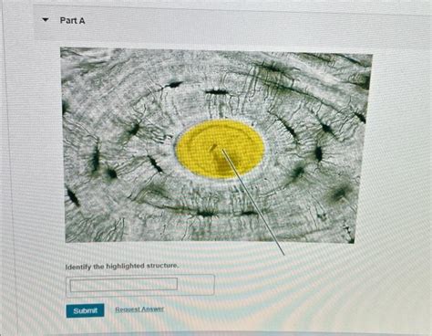 Solved Identify The Highlighted Structure Chegg