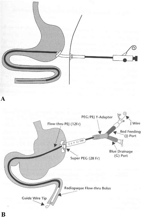 What exactly is a j-tube and how it works 8