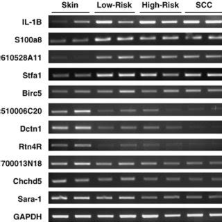 Validation Of Microarray Data By Semi Quantitative Reverse