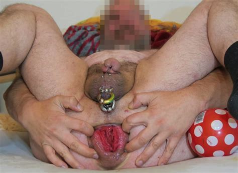 Extreme Analdehnung Nude Pics XHamster
