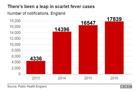 Scarlet Fever Cases Hit 50 Year High In England Bbc News