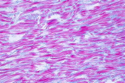 Human Cardiac Muscle Light Micrograph Stock Image F