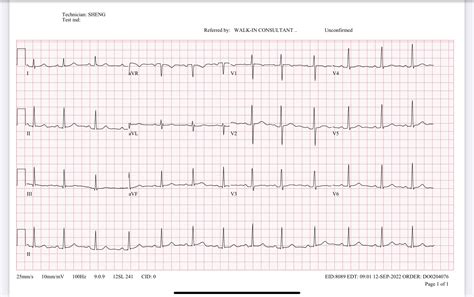 crat study material recg