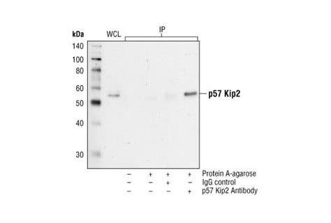 P57 Kip2 Antibody Cell Signaling Technology