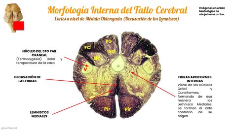 Solution Morfolog A Interna Del Tallo Cerebral Studypool