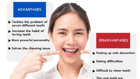 Comparing The Advantages And Disadvantages Of Braces Chiangmai