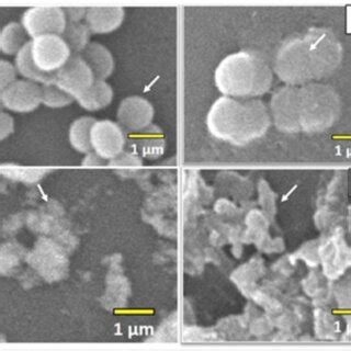 Scanning electron micrographs of S. aureus before (A) and after (B) 1 ...