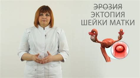 Эктопия шейки матки - причины, симптомы и лечение