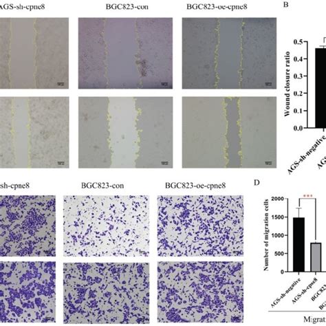 Cpne Promoted Gc Cell Migration And Invasion In Vitro A