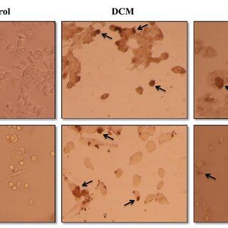 The Percentage Of Apoptosis And Necrosis In A MCF 7 And B WEHI 164