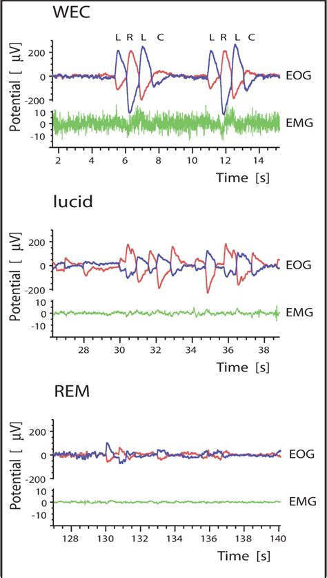 Figure 1 From Lucid Dreaming A State Of Consciousness With Features Of