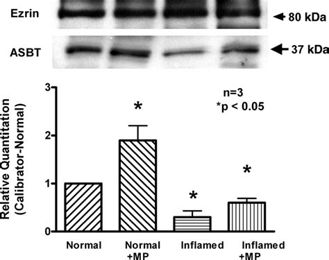 Immunoreactive levels of ASBT in the normal, inflamed, and MPtreated ...