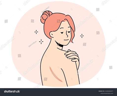 Naked Woman Scar On Back Female Stock Vector Royalty Free Shutterstock