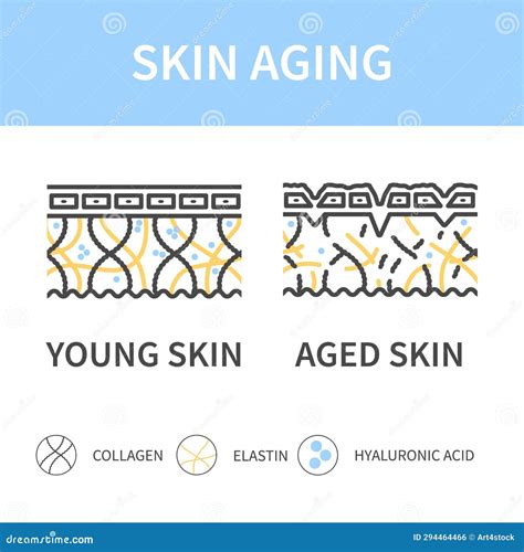 Young And Aging Skin Cross Section Diagram Vector Illustration | CartoonDealer.com #294464466