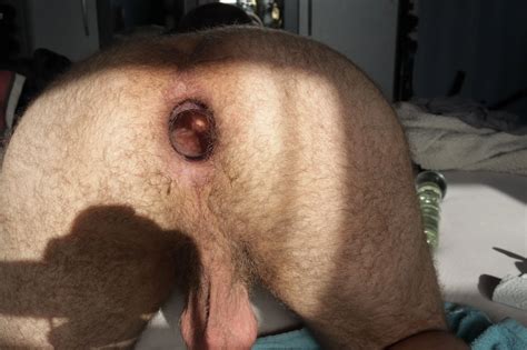 Plug De Vidro Anal 14 Pics XHamster