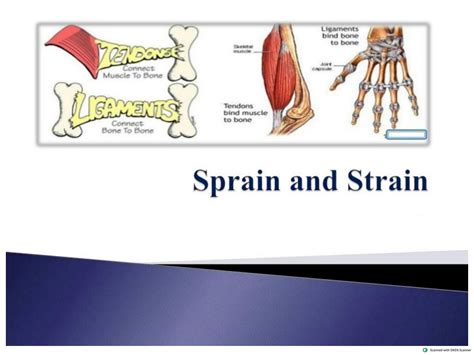 SOLUTION: Sprain vs. strain: Symptoms, causes, and treatment Notes ...