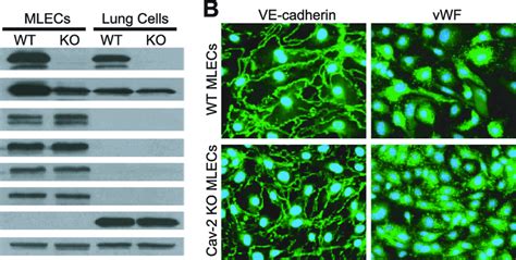 Isolation And Initial Characterization Of Mouse Lung Endothelial Cells