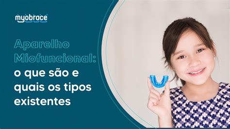 Aparelhos Miofuncionais o que são e quais os tipos existentes