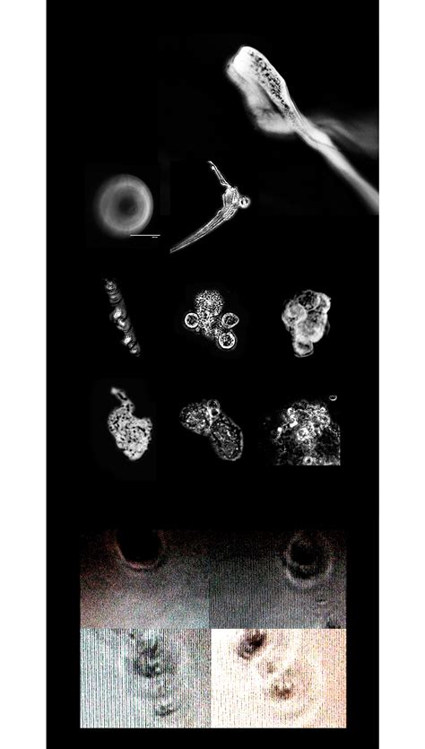 Immunoglobin and Cancer | Behance