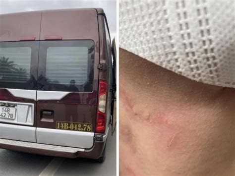 Nóng trên mạng Tổng hợp tin tức hình ảnh video HOT nhất