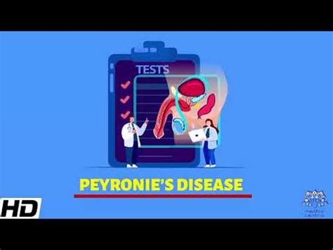 Peyronie S Disease Everything You Need To Know Youtube