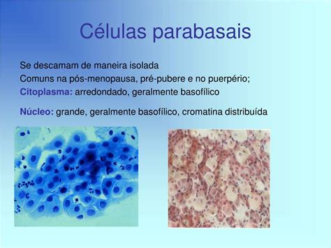Células Escamosas Intermediárias E Superficiais Parabasais Ausentes