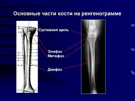 Лучевая диагностика костно-суставной системы - презентация онлайн