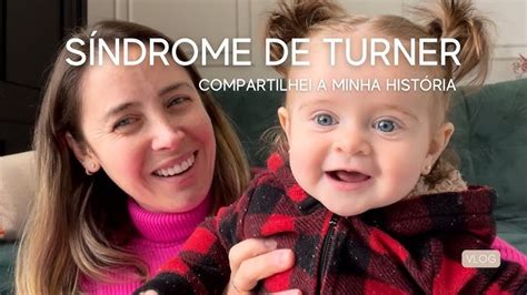 Fotos De Bebê Com Síndrome De Turner - Sindrome De Turner Bebe Explica Como Es El