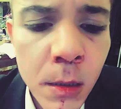 Bologna la denuncia di Gay Lex Pestato a sangue perché vestito da donna CorrierediBologna it