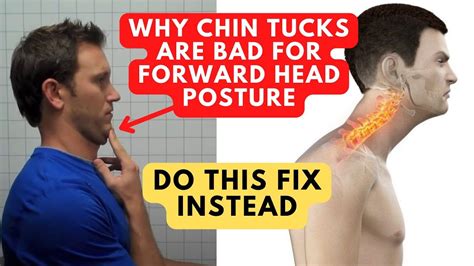 Stop Doing Chin Tucks For Forward Head Posture Do This Instead Chin Tuck Forward Head