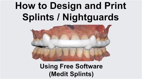 How To Design And Print Splints Nightguards Using Free Software Medit