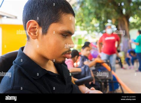 Managua, Nicaragua, March 21th 2022: A young Latin man with mental