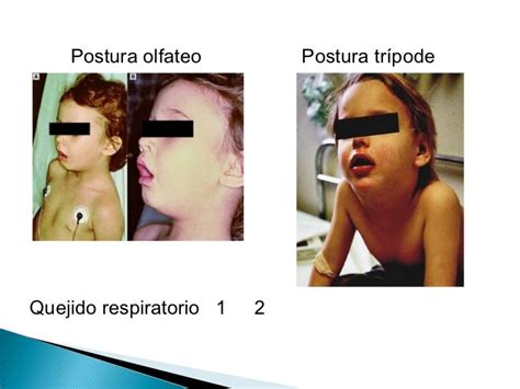 Triángulo evaluación pediátrica