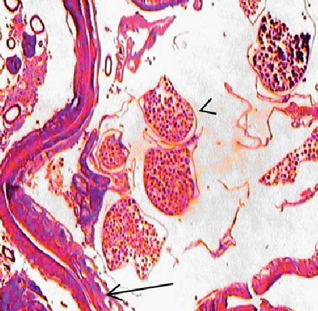 Histology of the parasite, solid arrow shows the hypodermal layer of ...