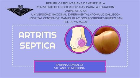 Artritis Séptica Sabrina Gonzalez uDocz