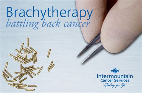 Brachytherapy an alternative to general radiation