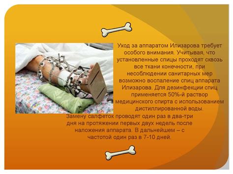 Виды остеосинтеза - презентация онлайн