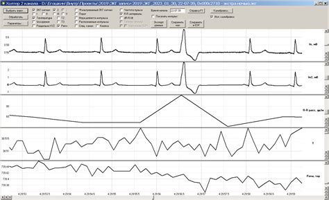 Программа для обработки и визуализации ЭКГ от кардиографа с записью на ...