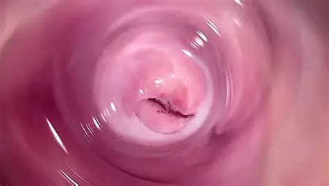 Internal Camera Deep Inside Mia S Creamy Pussy Welcome To My Vagina XHamster