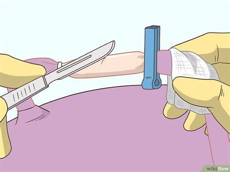 Como Cortar O Cordão Umbilical Em Caso De Emergência - 4 Formas de Cortar o Cordão Umbilical de um Bebê