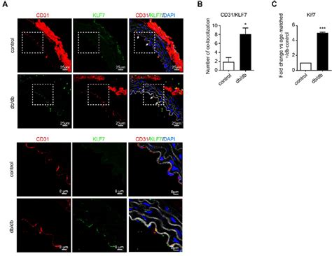 KLF7 is upregulated during EndMT-triggered aortic stiffening in db/db ...