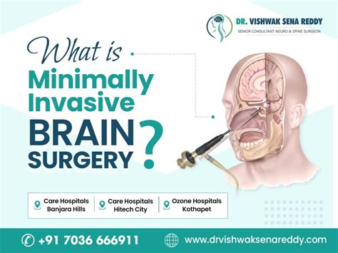 What Is Minimally Invasive Brain Surgery