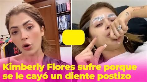 A Kimberly Flores se le cayó un diente postizo y ahora sufre por su