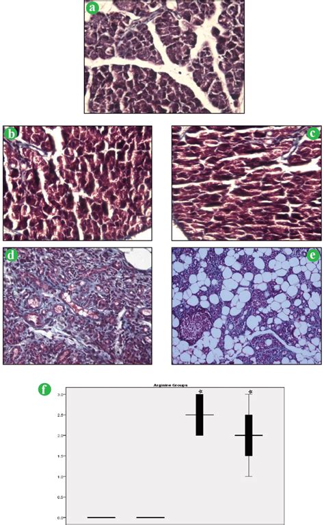 Histoarchitecture Of Rat Pancreas Showing A Control Group